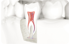 Endodontie Wurzelkanalbehandlung